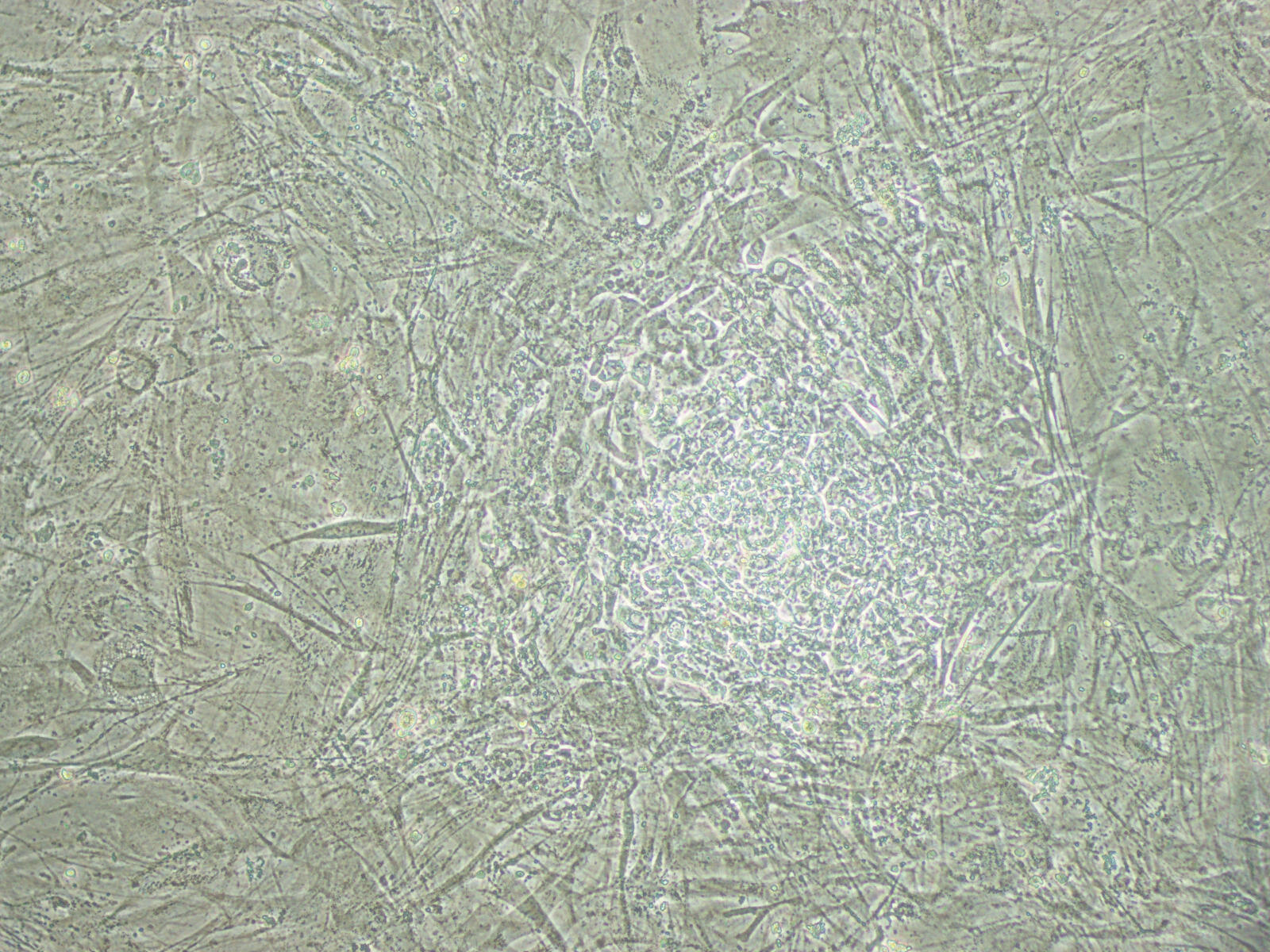 Human embryonic stem cell colonies.