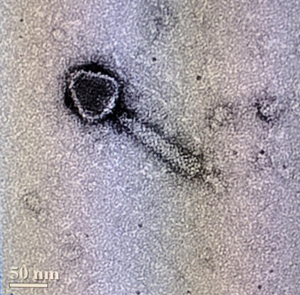 A transmission electron microscopy image of a bacteriophage.