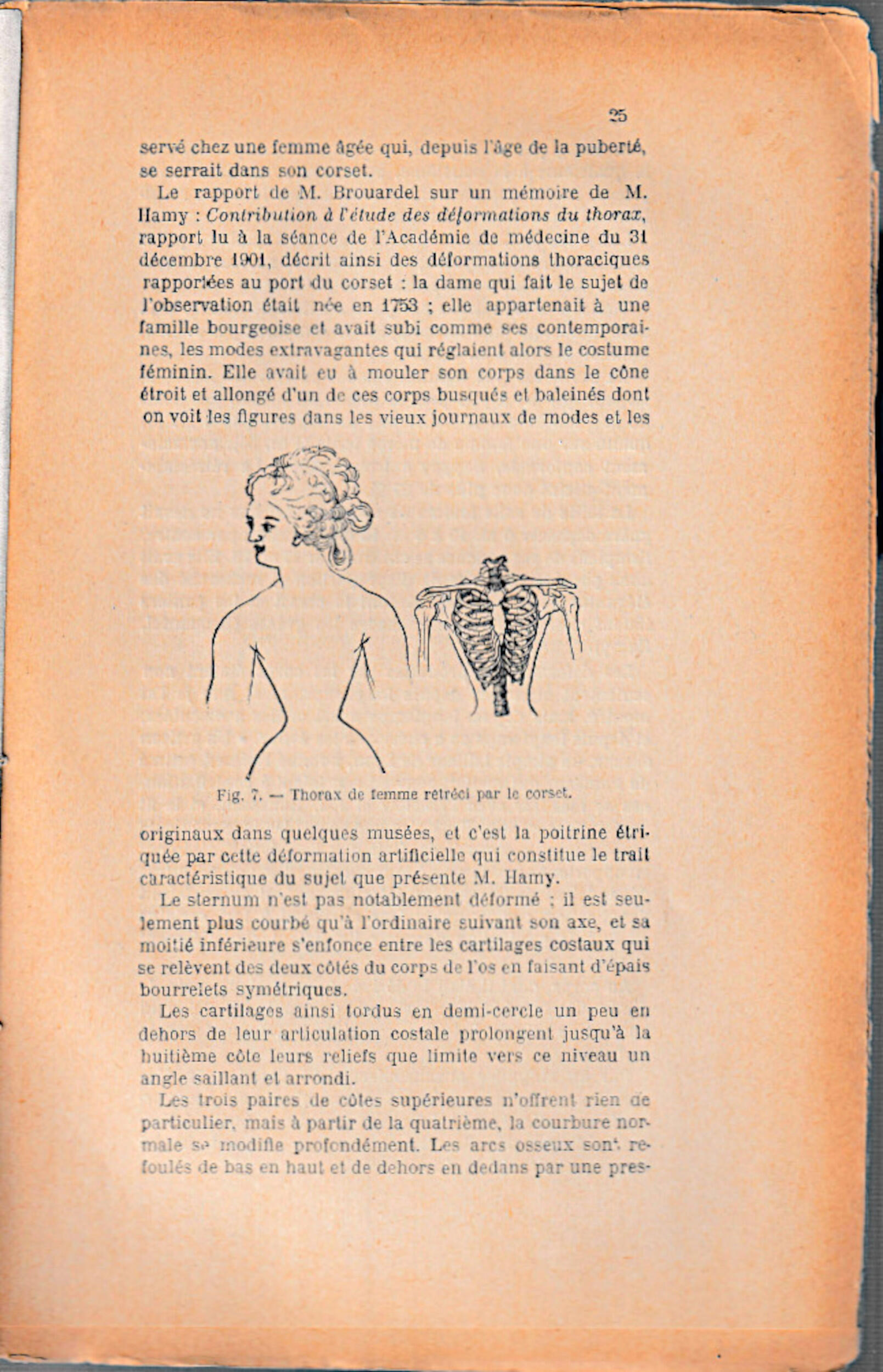 A scan of an old book page that has been yellowed with age. It shows an illustration of a woman with her waist bent. Next to the woman is an illustration of a skeletal rib cage. The text on the page is in French. 