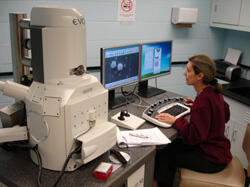 Scanning Electron Microscope (SEM) – Francine Marciano-Cabral, Ph.D., professor, Department of Microbiology and Immunology.