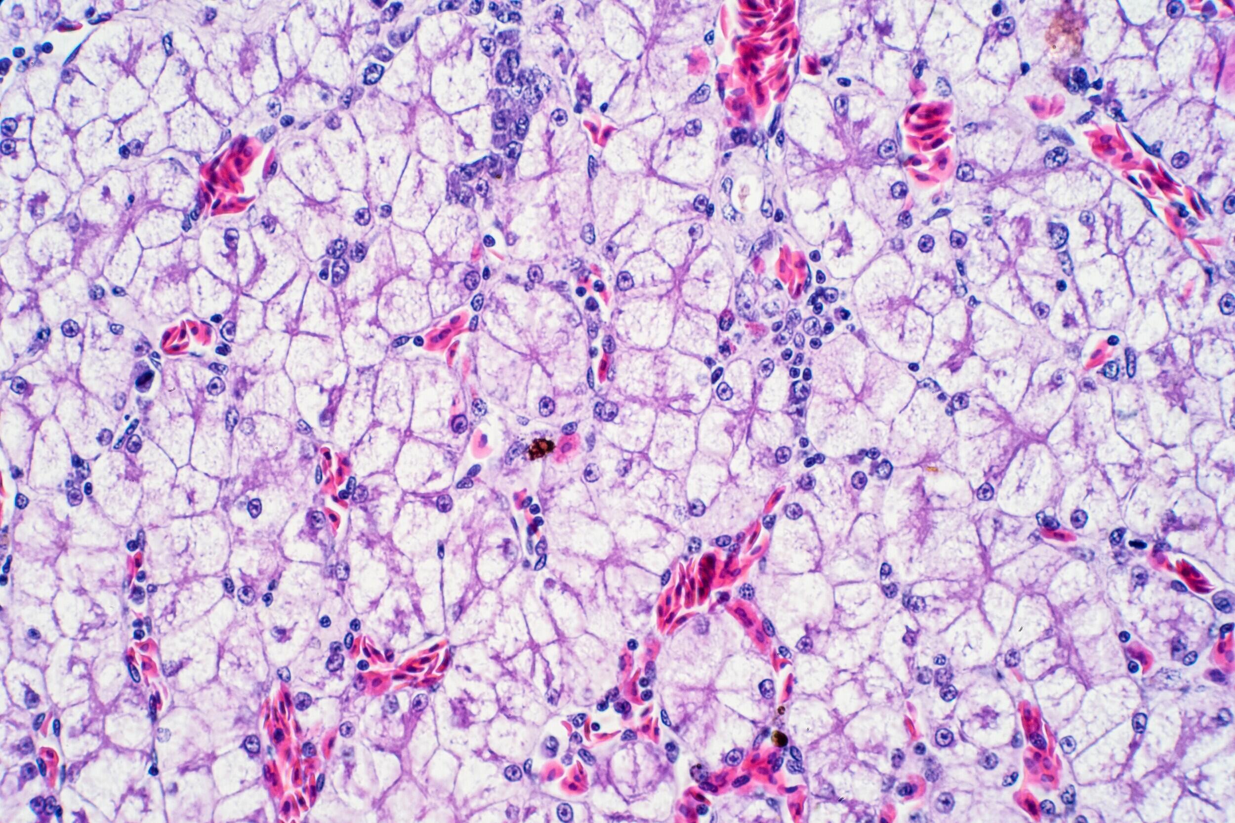Human liver tissue.