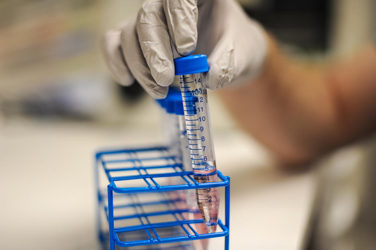 A hand placing a test tube into a holder.