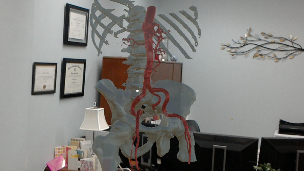 Anatomical visualization by the Med-AR program, which has been used by Tang to prep for cardiovascular surgeries. 