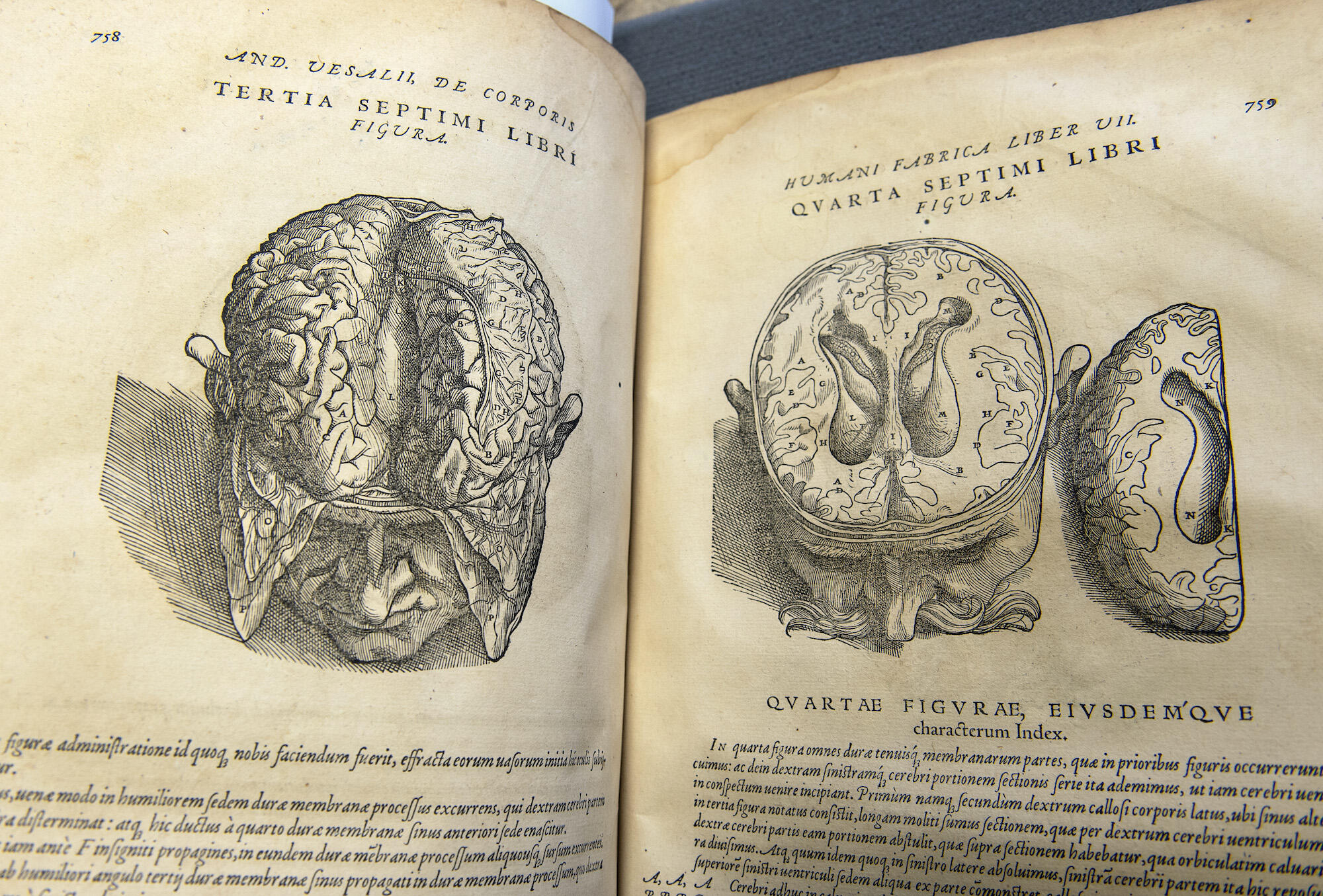 An illustration of the brain from \"De humnani corporis fabrica libri septum.\" 