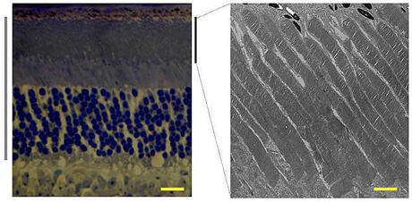 The photoreceptor layer (gray bar) of mouse retina contains 97% rods and 3% cones (left panel). The outer segment layer (black bar, right panel) is where phototransduction takes place. The yellow calibration bar equals 12 micrometers at left and 2 micrometers at right. Photographed by Anjali Rao 