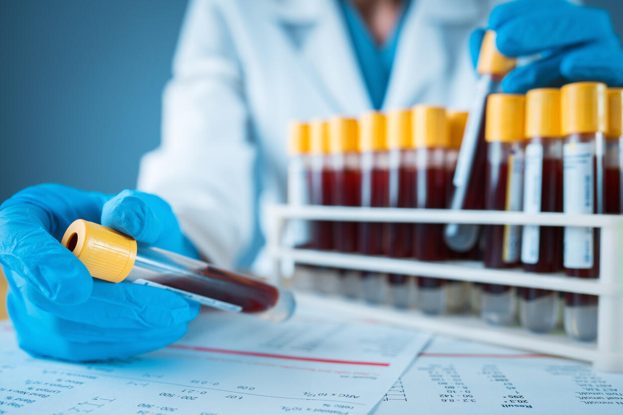 A person holds vials of blood samples.