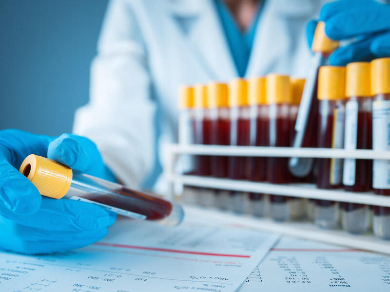 A person holds vials of blood samples.