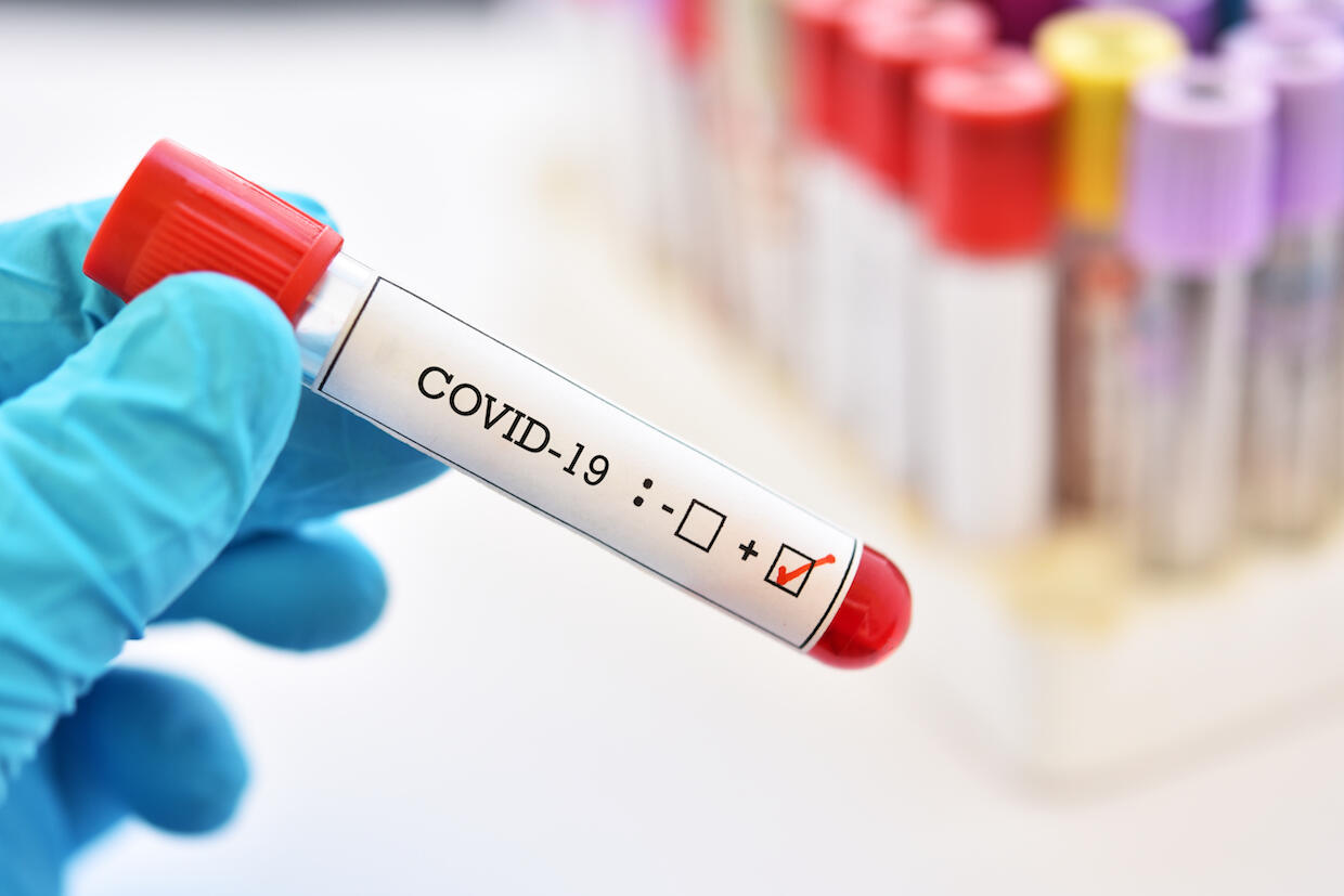A blood sample vial with COVID-19 written on the side.