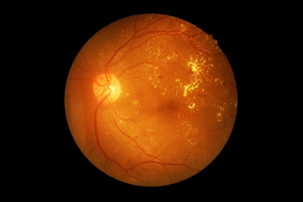 The interior of a human retina.