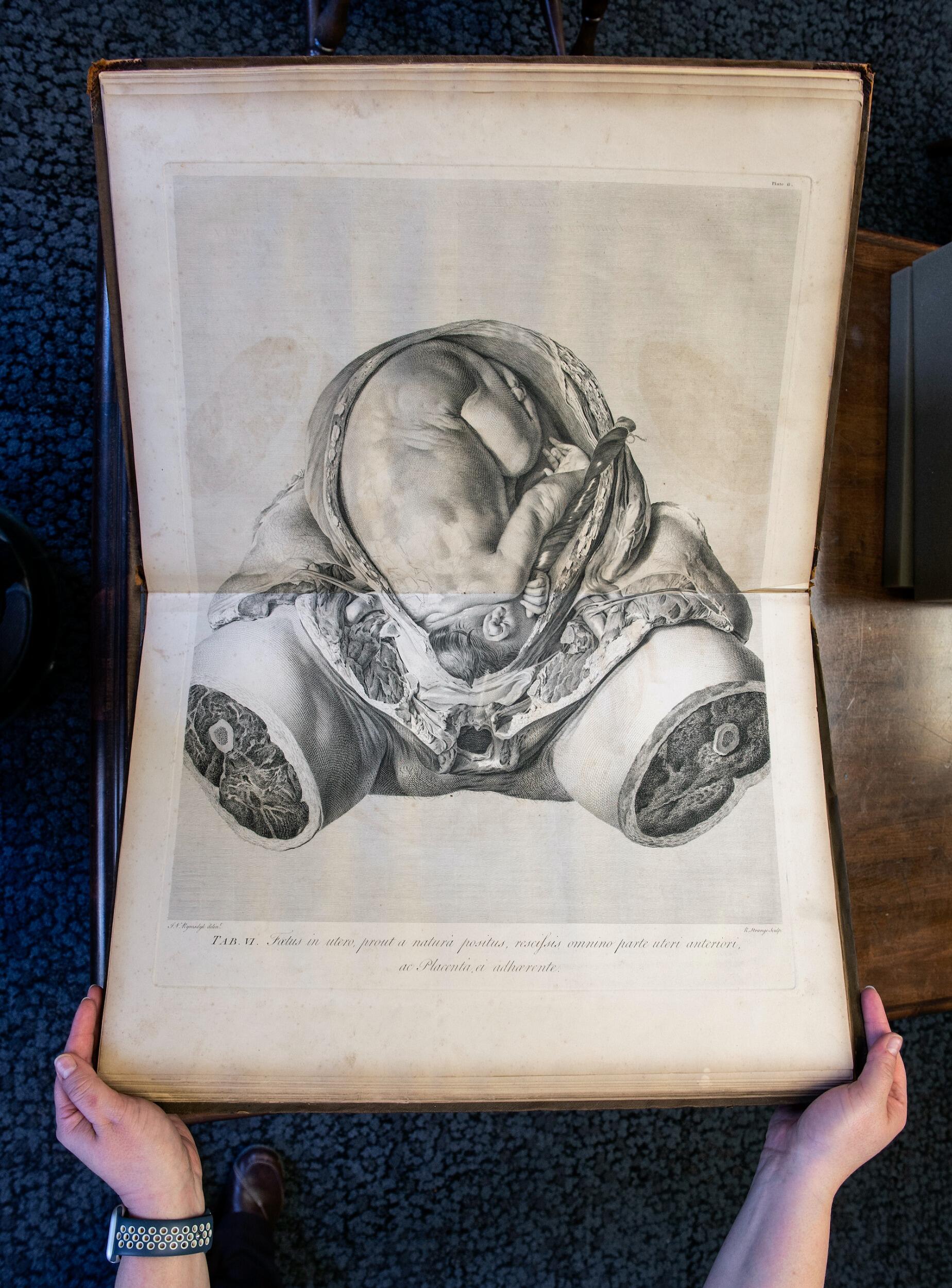 19th century medical illustration showing a fetus in utero 