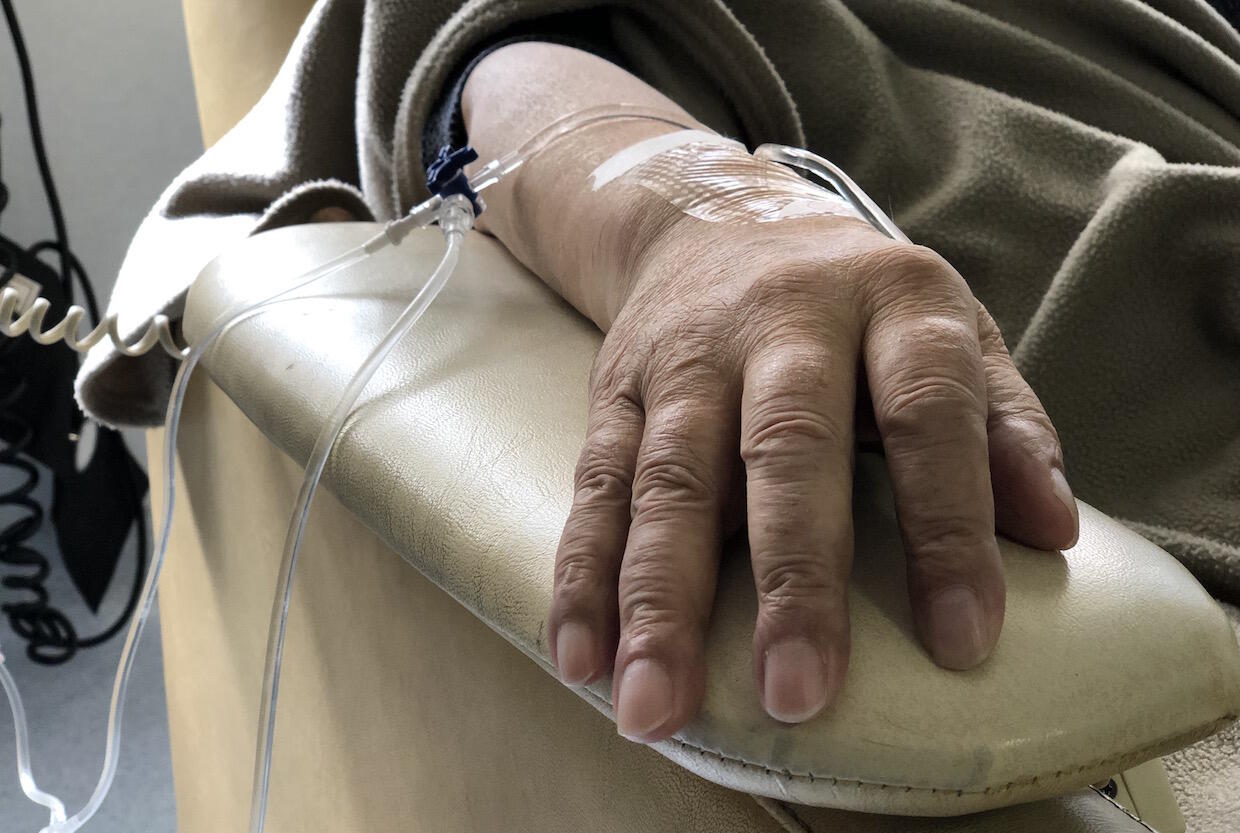 A person's with an IV line attached.