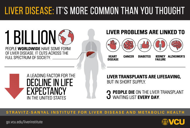 Infographic explaining how common liver disease is.