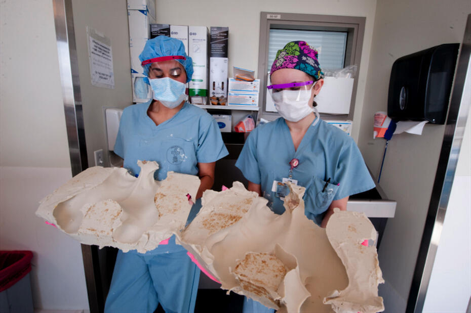 Yacoe, left, displays an alginate casting she took of Tapia conjoined twins, which she used to build a surgical model that her collaborator, Jennifer Rhodes, M.D., could use to prepare for her role in the separation surgery. (Photo courtesy of Morgan Yacoe)